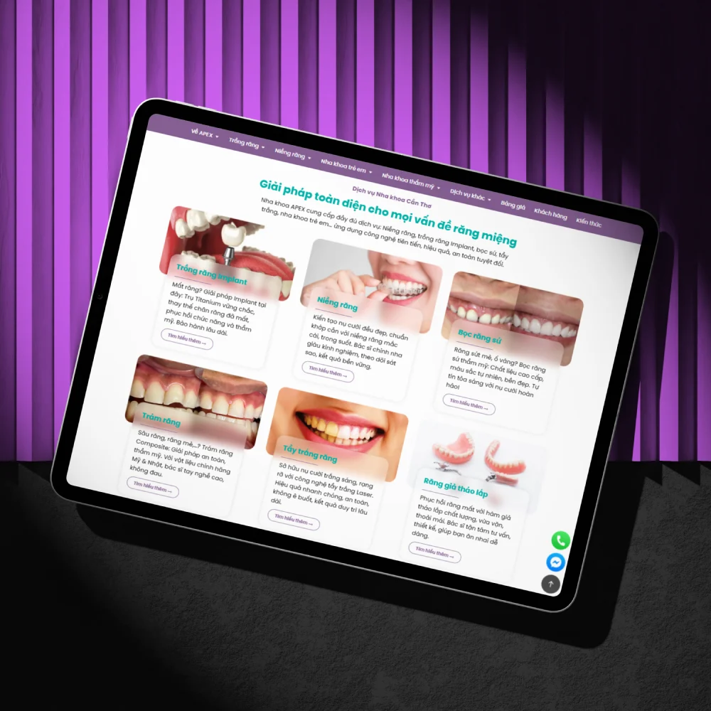 Giao diện máy tính bảng website Nha khoa APEX Cần Thơ