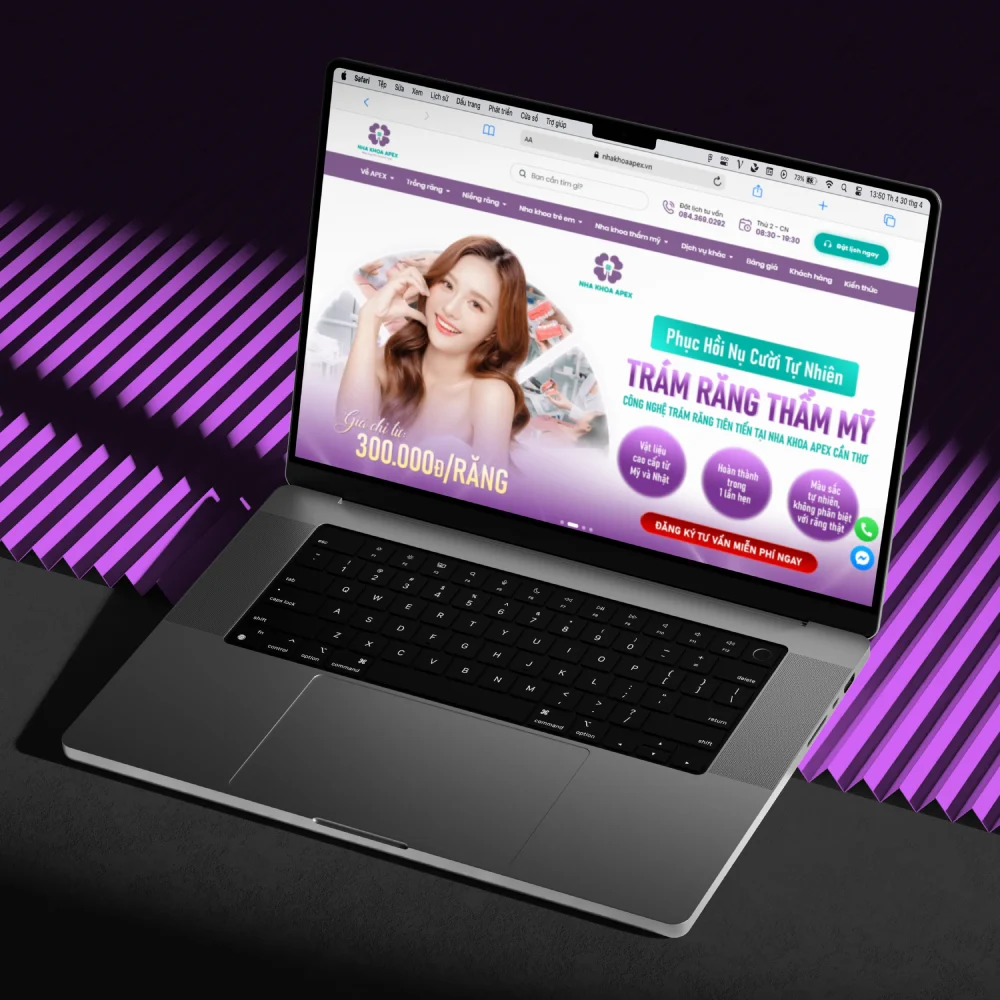 Giao diện máy tính website Nha khoa APEX Cần Thơ