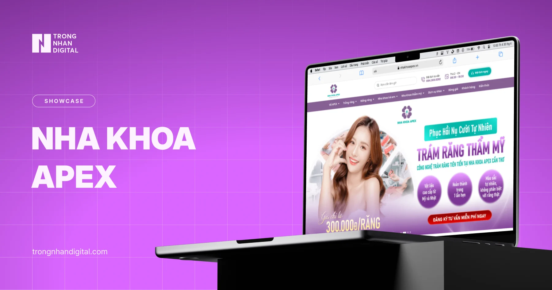Xây dựng hiện diện online chuyên nghiệp với website chuẩn SEO cho Nha khoa APEX Cần Thơ